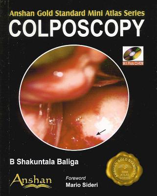 Mini Atlas of Colposcopy - Baliga, B Shakuntala