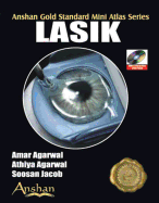 Mini Atlas of Lasik