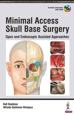 Minimal Access Skull Base Surgery: Open and Endoscopic Assisted Approaches - Boahene, Kofi (Editor), and Quiones-Hinojosa, Alfredo (Editor)