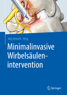 Minimalinvasive Wirbelsulenintervention