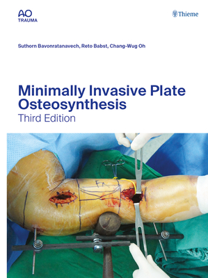 Minimally Invasive Plate Osteosynthesis - Bavonratanavech, Suthorn (Editor), and Babst, Reto (Editor), and Oh, Chang-Wug (Editor)