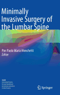 Minimally Invasive Surgery of the Lumbar Spine - Menchetti, Pier Paolo Maria (Editor)