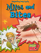 Mites and Bites