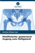 Modifizierter posteriorer Zugang zum H?ftgelenk