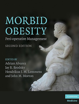 Morbid Obesity - Alvarez, Adrian (Editor)