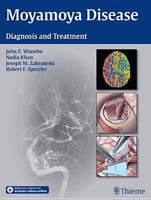 Moyamoya Disease: Diagnosis and Treatment - Wanebo, John E. (Editor), and Khan, Nadia (Editor), and Zabramski, Joseph M. (Editor)