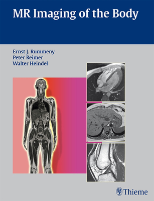 MR Imaging of the Body - Rummeny, Ernst (Editor), and Reimer, Peter (Editor), and Heindel, Walter (Editor)