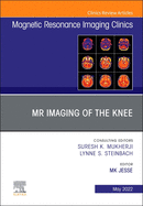 MR Imaging of the Knee, an Issue of Magnetic Resonance Imaging Clinics of North America: Volume 30-2