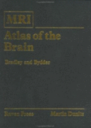 MRI Atlas of the Brain - Bradley, William G, and Bydder, Graeme