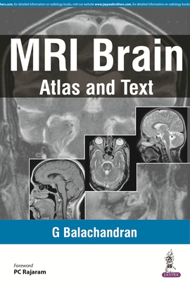 MRI Brain: Atlas and Text - Balachandran, G