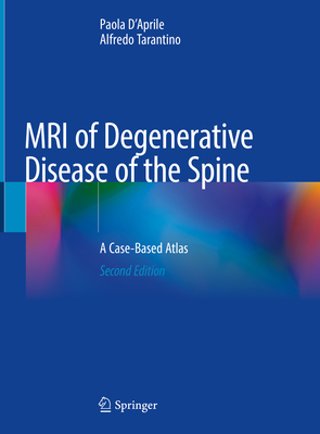 MRI of Degenerative Disease of the Spine: A Case-Based Atlas - D'Aprile, Paola, and Tarantino, Alfredo