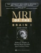 MRI of the Brain 1