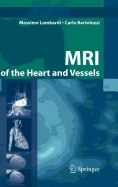 MRI of the Heart and Vessels