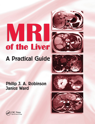 MRI of the Liver: A Practical Guide - Robinson, Philip J. A., and Ward, Janice
