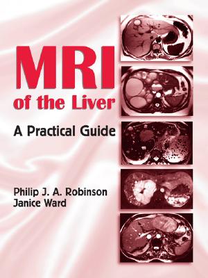 MRI of the Liver: A Practical Guide - Robinson, Philip J a, and Ward, Janice