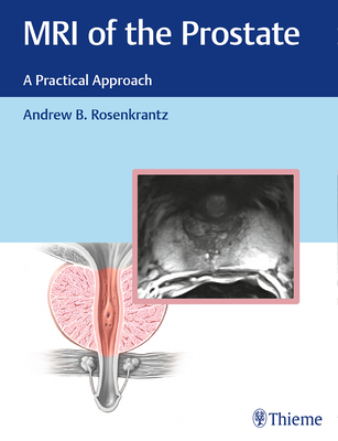 MRI of the Prostate: A Practical Approach - Rosenkrantz, Andrew (Editor)