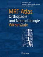 Mrt-Atlas: Orthopadie Und Neurochirurgie. Wirbelsaule