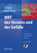 Mrt Des Herzens Und Der Gefe: Indikationen - Strategien - Ablufe - Ergebnisse