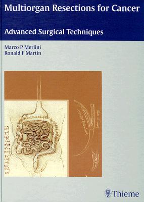 Multiorgan Resections for Cancer: Advanced Surgical Techniques - Merlini, Marco P, and Martin, Ronald F, and Dusmet, M (Contributions by)