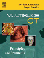 Multislice CT: Principles and Protocols
