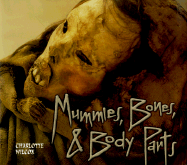 Mummies, Bones & Body Parts