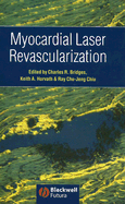Myocardial Laser Revascularization