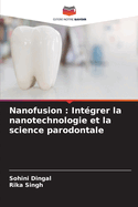 Nanofusion: Intgrer la nanotechnologie et la science parodontale