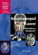 Nasopharyngeal Cancer: Multidisciplinary Management