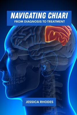 Navigating Chiari: From diagnosis to treatment - Rhodes, Jessica
