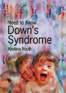 Need to Know: Downs Syndrome Paperback