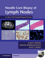 Needle Core Biopsy of Lymph Nodes with DVD-ROM: An Atlas of Hematopathological Disease - Ramsay, Alan D, and Rodriguez-Justo, Manuel, and Rodig, Scott J