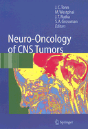 Neuro-Oncology of CNS Tumors