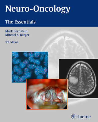 Neuro-Oncology: The Essentials - Bernstein, Mark (Editor), and Berger, Mitchel S (Editor)