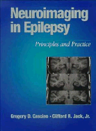 Neuroimaging in Epilepsy: Principles & Practice - Casino, Gregory, and Jack, Clifford R, MD