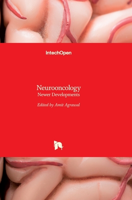 Neurooncology: Newer Developments - Agrawal, Amit (Editor)