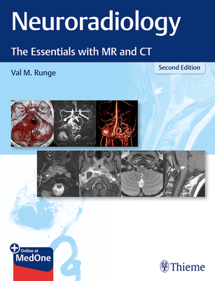Neuroradiology: The Essentials with MR and CT - Runge, Val M