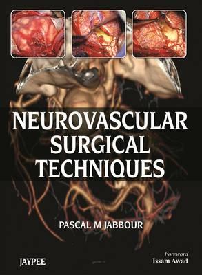 Neurovascular Surgical Techniques - Jabbour, Pascal M