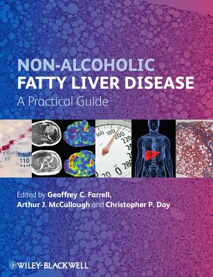 Non-Alcoholic Fatty Liver Disease: A Practical Guide - Farrell, Geoffrey C. (Editor), and McCullough, Arthur J. (Editor), and Day, Christopher P. (Editor)