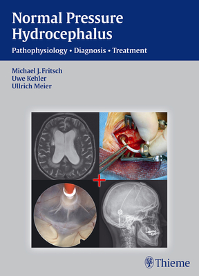 NPH - Normal Pressure Hydrocephalus: Pathophysiology - Diagnosis - Treatment - Fritsch, Michael J., and Kehler, Uwe, and Meier, Ullrich