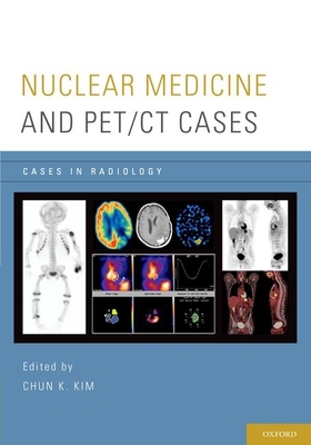 Nuclear Medicine and Pet/CT Cases - Kim, Chun K (Editor)
