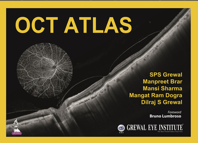 OCT Atlas - Grewal, SPS, and Brar, Manpreet, and Sharma, Mansi