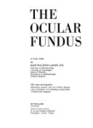 Ocular Fundus: A Color Atlas