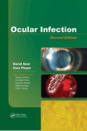 Ocular Infection: Investigation and Treatment in Practice
