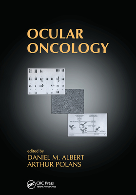 Ocular Oncology - Albert, Daniel M. (Editor), and Polans, Arthur (Editor)
