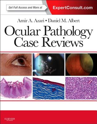 Ocular Pathology Case Reviews: Expert Consult - Online and Print - Azari, Amir A, and Albert, Daniel M, MD, MS