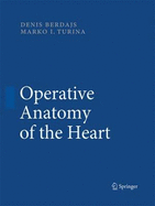 Operative Anatomy of the Heart