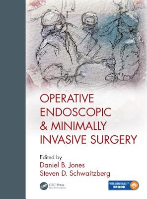 Operative Endoscopic and Minimally Invasive Surgery - Jones, Daniel B. (Editor), and Schwaitzberg, M.D., Steven (Editor)