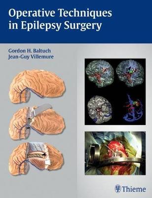 Operative Techniques in Epilepsy Surgery - Villemure, Jean-Guy (Editor)