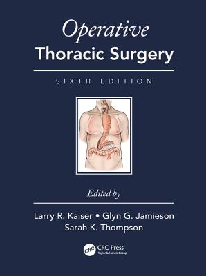Operative Thoracic Surgery - Kaiser, Larry R. (Editor), and Jamieson, Glyn (Editor), and Thompson, Sarah K. (Editor)