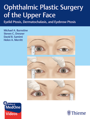 Ophthalmic Plastic Surgery of the Upper Face: Eyelid Ptosis, Dermatochalasis, and Eyebrow Ptosis - Burnstine, Michael A, and Dresner, Steven C, and Samimi, David B